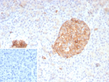 SYP Antibody Recombinant Mouse MAb Clone rSYP/8807. Immunohistochemistry analysis of FFPE human pancreas tissue shows strong cytoplasmic HRP-DAB brown staining in pancreatic islet cells, consistent with Synaptophysin (SYP) localization in neuroendocrine secretory vesicles. Positive staining highlights endocrine cells within the islets of Langerhans, while surrounding exocrine pancreatic tissue shows minimal staining. Hematoxylin counterstain marks nuclei in blue. Inset: PBS was used in place of the primary antibody as a secondary antibody negative control. The recombinant mouse monoclonal SYP antibody clone rSYP/8807 was used to detect synaptic vesicle protein expression in human pancreatic neuroendocrine cells. Heat-induced epitope retrieval was performed by boiling tissue sections in pH 9 10mM Tris with 1mM EDTA for 20 minutes followed by cooling prior to staining.