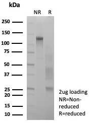 SDS-PAGE analysis of purified, BSA-free SYP Antibody Recombinant Mouse MAb Clone rSYP/8807 as confirmation of integrity and purity.