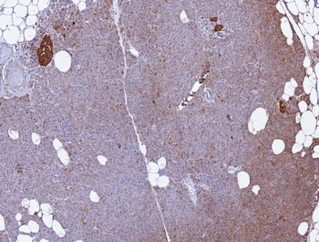 IHC staining of FFPE human pancreas tissue with CD99 antibody (clone MIC2/7866). HIER: boil tissue sections in pH 9 10mM Tris with 1mM EDTA for 20 min and allow to cool before testing.