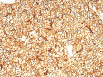 IHC staining of FFPE human pancreas tissue with CD99 antibody (clone MIC2/7864). HIER: boil tissue sections in pH 9 10mM Tris with 1mM EDTA for 20 min and allow to cool before testing.