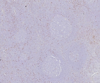 IHC staining of FFPE human tonsil tissue with Scurfin antibody (clone FOXP3/8145R). HIER: boil tissue sections in pH 9 10mM Tris with 1mM EDTA for 20 min and allow to cool before testing.