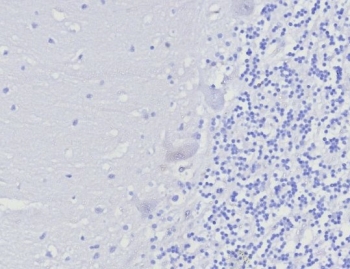 Negative control: IHC testing of FFPE human brain tissue with FOXP3 antibody (clone FOXP3/8277R) at 2ug/ml. HIER: boil tissue sections in pH 9 10mM Tris with 1mM EDTA for 20 min and allow to cool before testing.