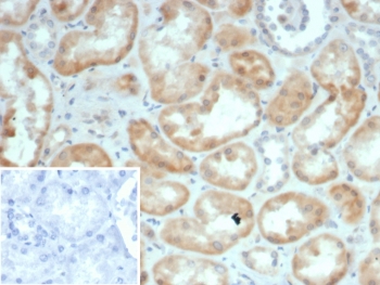 S100G Antibody Renal Tissue IHC. Immunohistochemistry analysis of S100 calcium binding protein G S100G expression in FFPE human kidney tissue using S100G antibody clone S100G/7461. Predominant cytoplasmic staining is observed in renal tubular epithelial cells, consistent with the role of Calbindin D9K as a vitamin D-regulated calcium-binding protein involved in calcium reabsorption, while glomerular structures and surrounding stroma show minimal staining. The negative control inset using PBS in place of primary antibody confirms specificity with absence of detectable signal. HIER: boil tissue sections in pH 9 10mM Tris with 1mM EDTA for 20 min and allow to cool before testing.