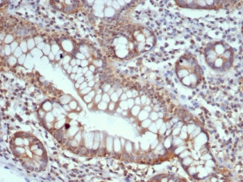 Calbindin D9K Antibody Small Intestine Tissue IHC. Immunohistochemistry analysis of Calbindin D9K S100G expression in FFPE human small intestine tissue using Calbindin D9K antibody clone S100G/7516. Strong cytoplasmic staining is observed in intestinal epithelial cells lining the villi, consistent with the role of this calcium-binding protein in transcellular calcium absorption, while underlying stromal cells show minimal signal. HIER: boil tissue sections in pH 9 10mM Tris with 1mM EDTA for 20 min and allow to cool before testing.