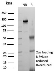 SDS-PAGE analysis of purified, BSA-free ACE2 / CD143 antibody (clone ACE2/8748R) as confirmation of integrity and purity.