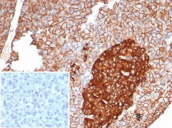 IHC staining of FFPE human pancreas tissue with CD99 antibody (clone MIC2/7865). Inset: PBS used in place of primary Ab (secondary Ab negative control). HIER: boil tissue sections in pH 9 10mM Tris with 1mM EDTA for 20 min and allow to cool before testing.