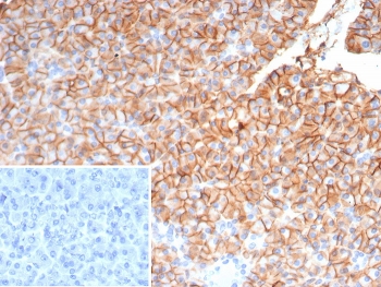 IHC staining of FFPE human pancreas tissue with CD99 antibody (clone MIC2/7862). Inset: PBS used in place of primary Ab (secondary Ab negative control). HIER: boil tissue sections in pH 9 10mM Tris with 1mM EDTA for 20 min and allow to cool before testing.