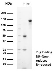 SDS-PAGE analysis of purified, BSA-free CD99 antibody (clone MIC2/7862) as confirmation of integrity and purity.