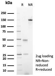 SDS-PAGE analysis of purified, BSA-free AR antibody (clone DHTR/4929R) as confirmation of integrity and purity.