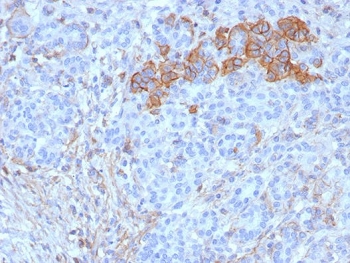 IHC staining of FFPE human pancreas tissue with recombinant CD99/MIC2 antibody (clone rMIC2/6939). Membranous brown staining is observed in a subset of pancreatic epithelial cells, while surrounding stromal cells show minimal to no signal. Nuclei are counterstained blue. Heat-induced epitope retrieval was performed by boiling tissue sections in pH 9 10mM Tris with 1mM EDTA for 20 min followed by cooling prior to staining.