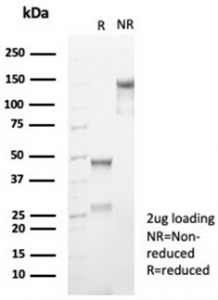 SDS-PAGE analysis of purified, BSA-free recombinant CD99/MIC2 antibody (clone rMIC2/6939) as confirmation of integrity and purity.