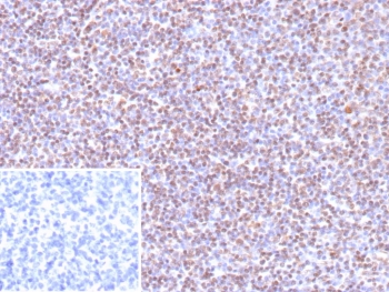 IHC staining of FFPE human tonsil tissue with recombinant Epstein-Barr Virus antibody (clone EBV/9619R). Inset: PBS used in place of primary Ab (secondary Ab negative control).