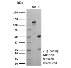 SDS-PAGE analysis of purified, BSA-free Blood Group Lewis y antibody (clone LWY/9243R) as confirmation of integrity and purity.