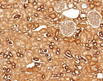Recombinant Cadherin 16 Antibody Kidney IHC. Immunohistochemical analysis of Cadherin-16 / CDH16 expression in formalin-fixed, paraffin-embedded human kidney tissue using CDH16 antibody. Strong membranous and luminal staining is observed in renal tubular epithelial cells, with clear visualization of tubular structures and glomerular regions consistent with kidney-specific expression of CDH16.