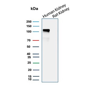 Cadherin 16 Antibody Human and Rat Kidney WB. Western blot analysis of Cadherin-16 / CDH16 expression in kidney tissue lysates using Cadherin 16 antibody clone CDH16/9611R. Lane 1: human kidney lysate, Lane 2: rat kidney lysate. A strong band is detected at approximately 100-110 kDa in human kidney lysate, consistent with the predicted molecular weight of Cadherin-16 (CDH16), with the slightly higher apparent migration reflecting glycosylation of this kidney-restricted adhesion protein. Minimal or no detectable signal is observed in rat kidney lysate under these conditions, indicating preferential detection in human tissue.