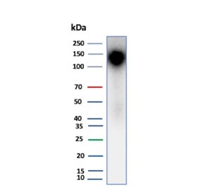 Ksp-Cadherin Antibody Human Kidney WB. Western blot testing of human kidney tissue lysate using Ksp-Cadherin antibody (clone rCDH16/7343). Expected molecular weight ~130 kDa.