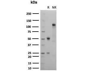 SDS-PAGE analysis of purified, BSA-free recombinant Ksp-Cadherin antibody (clone rCDH16/7343) as confirmation of integrity and purity.