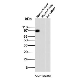 Ksp-Cadherin Antibody Kidney Tissue WB. Western blot analysis of Cadherin-16 (CDH16), also known as Ksp-Cadherin, expression in kidney tissue lysates using Ksp-Cadherin antibody clone rCDH16/7343. Lane 1: human kidney lysate, Lane 2: mouse kidney lysate, Lane 3: rat kidney lysate. A band is detected at approximately 90-100 kDa in human kidney lysate, consistent with the predicted molecular weight of Ksp-Cadherin (CDH16), a kidney-specific adhesion protein. Minimal or no detectable signal is observed in mouse and rat kidney lysates under these conditions, suggesting preferential detection in human tissue for this clone.