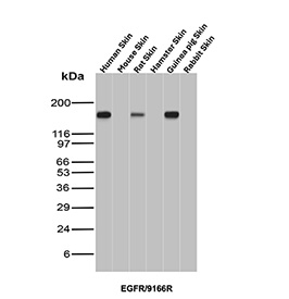 EGFR Antibody Skin Tissue WB. Western blot analysis of skin tissue lysates from multiple species using EGFR antibody detecting Epidermal growth factor receptor, clone EGFR/9166R. Lanes include human skin, mouse skin, rat skin, hamster skin, guinea pig skin, and rabbit skin. A predominant band is observed at approximately 150-180 kDa across species, consistent with the predicted molecular weight of EGFR and its glycosylated forms. The consistent banding pattern supports EGFR expression in epithelial-rich skin tissue across species.