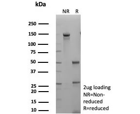 SDS-PAGE analysis of purified, BSA-free recombinant Epidermal growth factor receptor antibody (clone EGFR/9166R) as confirmation of integrity and purity.