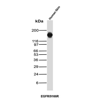 Western blot testing of human A431 cell lysate with recombinant Epidermal growth factor receptor antibody (clone EGFR/9166R). Expected molecular weight: 134-180 kDa depending on glycosylation level.