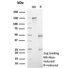 SDS-PAGE analysis of purified, BSA-free Alpha-2-Macroglobulin antibody (clone A2M/6553) as confirmation of integrity and purity.