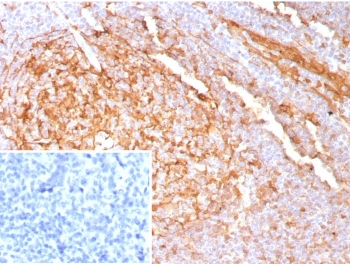 Cystatin A Antibody FFPE Human Tonsil Tissue IHC. Immunohistochemistry analysis of Cystatin A in human tonsil tissue. Formalin-fixed, paraffin-embedded human tonsil tissue was stained using recombinant Cystatin A antibody (clone CSTA/9087R), showing cytoplasmic staining in epithelial and lymphoid-associated cells consistent with known Cystatin A expression patterns. Heat-induced epitope retrieval was performed by boiling tissue sections in 10 mM Tris with 1 mM EDTA, pH 9.0, for 20 minutes, followed by cooling prior to immunostaining. Inset shows PBS substituted for the primary antibody as a secondary antibody-only negative control.