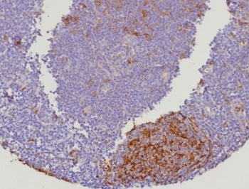 Cystatin A Antibody Human Lymph Node Immunohistochemistry. IHC staining of FFPE human lymph node tissue with recombinant Cystatin A antibody (clone CSTA/9087R). HIER: boil tissue sections in pH 9 10mM Tris with 1mM EDTA for 20 min and allow to cool before testing.