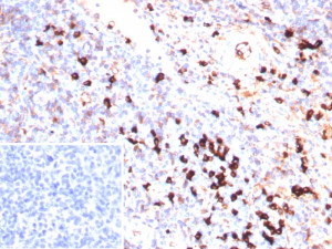 Lambda Light Chain Antibody LLC/9397R Immunohistochemistry. IHC staining of FFPE human tonsil tissue with recombinant Lambda Light Chain antibody (clone LLC/9397R). Inset: PBS used in place of primary Ab (secondary Ab negative control).