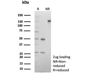 SDS-PAGE analysis of purified, BSA-free COL4A3 antibody (clone COL4/9395R) as confirmation of integrity and purity.
