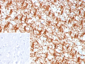 IHC staining of FFPE human brain tissue with recombinant MBP antibody (clone rMBP/9301). Inset: PBS used in place of primary Ab (secondary Ab negative control). HIER: boil tissue sections in pH 9 10mM Tris with 1mM EDTA for 20 min and allow to cool before testing.