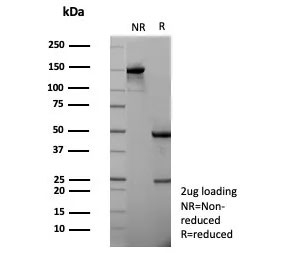 SDS-PAGE analysis of purified, BSA-free Apolipoprotein H antibody (clone APOH/3682) as confirmation of integrity and purity.