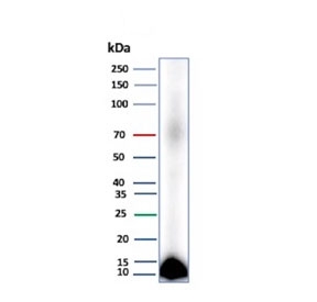 Colipase Antibody Human Pancreas WB. Western blot analysis of human pancreas tissue lysate using Colipase antibody. The mouse monoclonal antibody clone CLPS/9026 detects a strong band at approximately 12 kDa, consistent with the predicted molecular weight of Colipase / CLPS. Robust signal in pancreatic tissue reflects expression of this secreted lipase cofactor in acinar cells, supporting its role in exocrine secretion and digestive enzyme function, while minimal background indicates specific target detection.