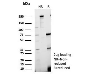 SDS-PAGE analysis of purified, BSA-free Sex Hormone Binding Globulin antibody (clone SHBG/8924) as confirmation of integrity and purity.