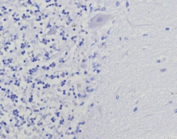 Negative control: IHC staining of FFPE human brain tissue using recombinant Thymidylate Synthase antibody (clone TYMS/9091R). HIER: boil tissue sections in pH 9 10mM Tris with 1mM EDTA for 20 min and allow to cool before testing.