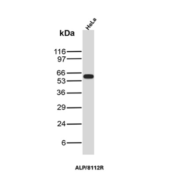 PLAP Antibody HeLa WB. Western blot analysis of HeLa cell lysate using PLAP Antibody / Placental Alkaline Phosphatase Antibody (clone ALP/8112R) detects a prominent band at approximately 63-66 kDa, consistent with placental alkaline phosphatase / ALPP. The observed molecular weight is higher than the predicted core protein size due to glycosylation and post-translational processing characteristic of this glycosylphosphatidylinositol-anchored alkaline phosphatase family member.