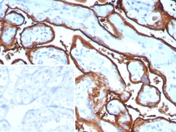 Immunohistochemistry of ALPP Antibody Rabbit Monoclonal ALPP/9109R in human tonsil. Formalin-fixed, paraffin-embedded human tonsil tissue demonstrates membranous HRP-DAB brown staining in epithelial structures, while surrounding lymphoid areas show minimal staining. The inset shows PBS used in place of the primary antibody as a negative control.