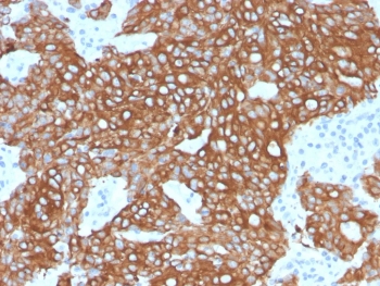 IHC staining of FFPE human colon tissue with recombinant CK8/18 antibody (KRT8.18/6579R). HIER: boil tissue sections in pH 9 10mM Tris with 1mM EDTA for 20 min and allow to cool before testing.