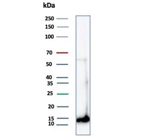 Western blot testing of human kidney tissue lysate using FABP1 antibody (clone FABP1/4462). Predicted molecular weight: ~14 kDa.