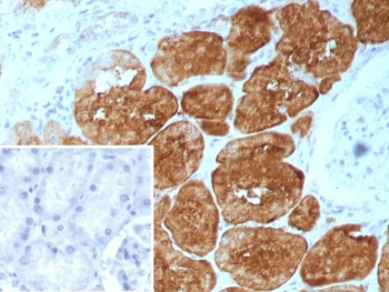 Immunohistochemistry of Fatty Acid Binding Protein 1 antibody in human kidney. FFPE human kidney tissue was stained with Fatty Acid Binding Protein 1 antibody rabbit mAb clone FABP1/9085R. Strong cytoplasmic HRP-DAB brown staining is observed in renal tubular epithelial cells, consistent with known FABP1 expression in proximal tubules, while glomerular structures show minimal to absent staining. The inset image shows the PBS negative control with no primary antibody, demonstrating absence of specific staining. Heat induced epitope retrieval was performed by boiling tissue sections in pH 9 Tris-EDTA buffer for 20 minutes followed by cooling prior to antibody incubation.