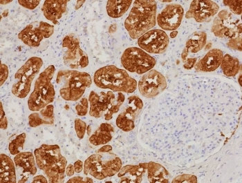 IHC staining of FFPE human kidney tissue with Fatty Acid Binding Protein 1 antibody (clone FABP1/9085R). HIER: boil tissue sections in pH 9 10mM Tris with 1mM EDTA for 20 min and allow to cool before testing.