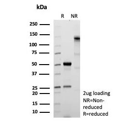 SDS-PAGE analysis of purified, BSA-free Fatty Acid Binding Protein 1 antibody (clone FABP1/9085R) as confirmation of integrity and purity.