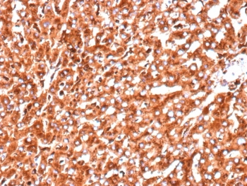 Cathepsin D Antibody Pancreatic Tissue IHC. Immunohistochemistry analysis of FFPE human pancreas tissue using recombinant Cathepsin D antibody (clone CTSD/9613R) shows strong granular cytoplasmic staining throughout pancreatic cells, consistent with CTSD / Cathepsin D localization in lysosomal compartments. The punctate staining pattern reflects lysosomal protease distribution associated with intracellular protein processing and turnover. Tissue architecture is well preserved, and surrounding stromal regions display comparatively lower staining. Hematoxylin counterstain provides nuclear contrast and structural context. HIER: boil FFPE tissue sections in pH 9 10 mM Tris with 1 mM EDTA for 20 min and allow to cool before testing.