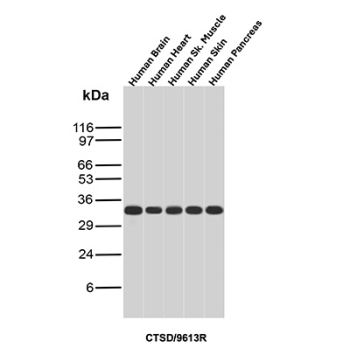 Cathepsin D Antibody Human Tissue Panel WB. Western blot analysis of human 1) brain, 2) heart, 3) skeletal muscle, 4) skin, and 5) pancreas tissue lysates using Cathepsin D Antibody (clone CTSD/9613R) detects a consistent band at approximately 30-35 kDa across all samples, corresponding to the processed mature form of Cathepsin D (CTSD). Cathepsin D is synthesized as a larger precursor that undergoes proteolytic cleavage to generate active heavy and light chain fragments, with the observed band reflecting the predominant mature species. The uniform banding pattern across tissues supports reliable detection of CTSD and is consistent with its widespread lysosomal expression.