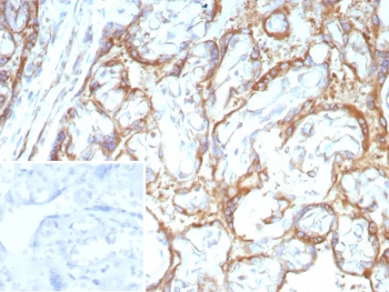 Immunohistochemistry analysis of RET / c-RET antibody (clone RET/8786) in human placental tissue. FFPE human placenta demonstrates membranous and cytoplasmic HRP-DAB brown staining in trophoblastic cells, consistent with RET expression. Staining highlights cell membranes outlining chorionic villi with additional cytoplasmic signal, while surrounding stromal regions show comparatively weaker reactivity. Nuclei are counterstained blue. The inset image represents a secondary antibody negative control in which PBS was used in place of the primary antibody and shows absence of specific staining. Heat induced epitope retrieval was performed by boiling tissue sections in 10 mM Tris with 1 mM EDTA, pH 9.0, for 20 minutes followed by cooling prior to immunostaining.