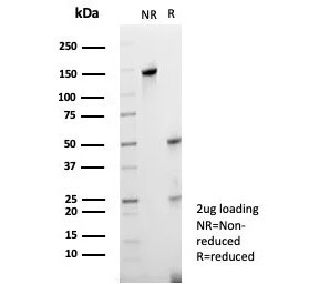 SDS-PAGE analysis of purified, BSA-free RET/c-RET antibody (clone RET/8786) as confirmation of integrity and purity.