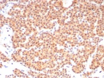 Immunohistochemistry analysis of c-RET / RET Proto-Oncogene antibody (clone RET/8790) in human parathyroid tissue. FFPE human parathyroid demonstrates cytoplasmic and membranous HRP-DAB brown staining in parathyroid epithelial cells, consistent with RET expression. Staining is diffuse across the glandular cell population with moderate intensity, while stromal elements show comparatively weaker signal. Nuclei are counterstained blue. Heat induced epitope retrieval was performed by boiling tissue sections in 10 mM Tris with 1 mM EDTA, pH 9.0, for 20 minutes followed by cooling prior to immunostaining.