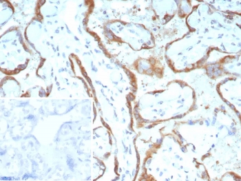 IHC staining of FFPE human placental tissue with c-RET/RET Proto-Oncogene antibody (clone RET/8790). Inset: PBS used in place of primary Ab (secondary Ab negative control). HIER: boil tissue sections in pH 9 10mM Tris with 1mM EDTA for 20 min and allow to cool before testing.