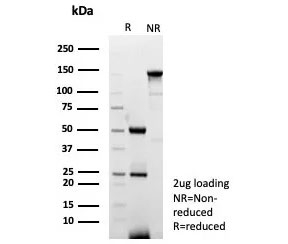SDS-PAGE analysis of purified, BSA-free CD14 antibody (clone LPSR/7738) as confirmation of integrity and purity.