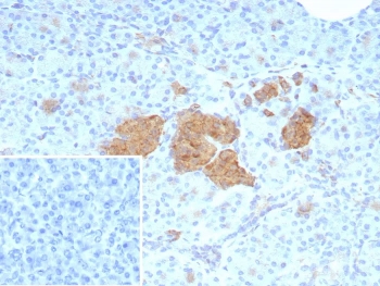 NSE gamma Antibody Human Pancreas IHC. Immunohistochemistry staining of FFPE human pancreas tissue with NSE gamma antibody (clone ENO2/9044). Inset: PBS used in place of primary Ab (secondary Ab negative control). HIER: boil tissue sections in pH 9 10mM Tris with 1mM EDTA for 20 min and allow to cool before testing.